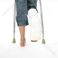 Girl with a broken leg walking on crutches