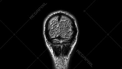Voluminous MRI scans of the brain and head to detect tumors. Diagnostic medical tool