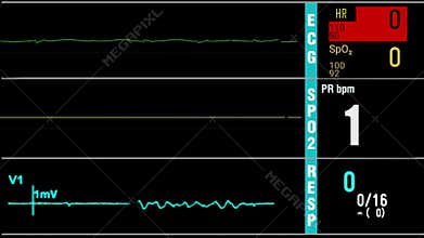 Heart rate, pressure rate, oxygen saturation, respiration indication. Mock up, banner, ICU monitor or display in a