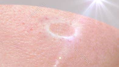 Lotions or creams drip onto the skin to increase moisture