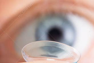 Contact lens