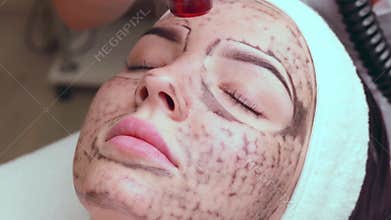 Beautician doing hardware carbon peeling to a young beautiful client in a