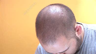 Man shaking his head and going mad