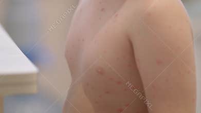 A child displaying a skin condition chickenpox is observed in a natural environment setting nearby