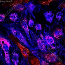 Mesenchymal stem cells