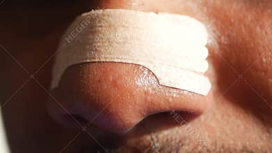 Nasal Strips, Snoring Aids for Men, Improved Nasal Breathing