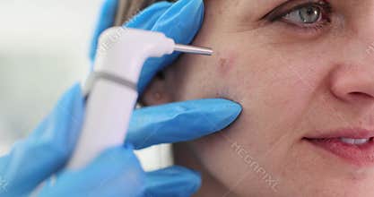 Dermatologist examines pimple on cheek of patient in clinic