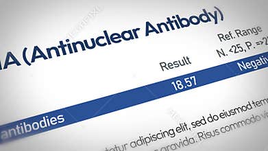 Close up view of a medical laboratory report showing antinuclear antibody ana blood test results with negative indicator video