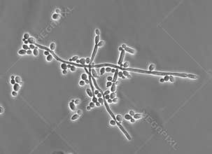 Stock photo of Candida abicans