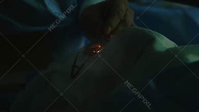 Correction for vision - ophthalmology surgery, laser impact
