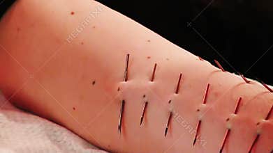Piercing on the body.