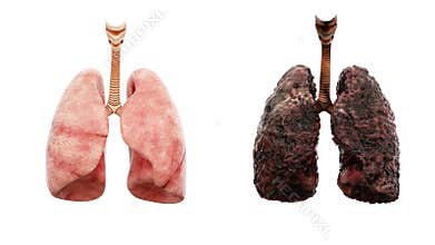 Healthy lungs and disease lungs on white isolate. Autopsy medical concept. Cancer and smoking problem.