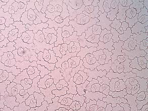 Leaf epidermis