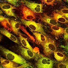 Ceramide bubbles surroud the cells