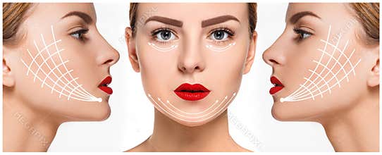 The young female face. Antiaging and thread lifting concept