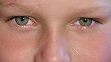 Blinking Eyes Of Child