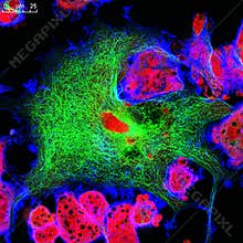 Real fluorescence microscopic view of mice neuroblastoma cell line