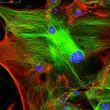 Confocal microscopy of fibroblast cells
