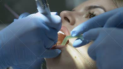 Medical dentist procedure of teeth polishing with cleaning from dental deposit and odontolith