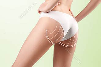 The cellulite removal plan. White markings on young woman body