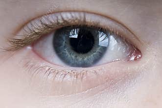 Eye