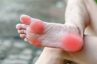 Male foot pain, Man's problem concept