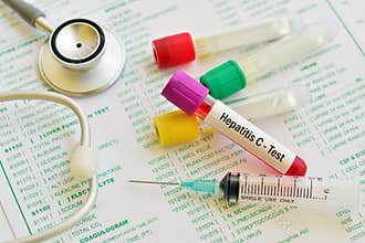 Hepatitis C test
