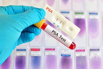 PSA testing