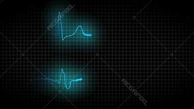 Cardiogram healthy heart and cardiogram sick heart
