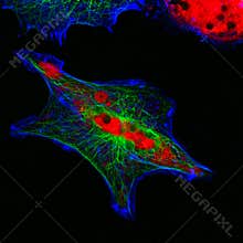 Real fluorescence microscopic view of human neuroblastoma cells