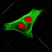 Real fluorescence microscopic view of human neuroblastoma cells