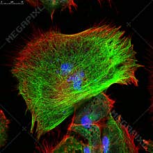 Confocal microscopy of fibroblast cells