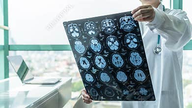 Brain disease diagnosis with medical doctor seeing Magnetic Resonance Imaging MRI film diagnosing elderly ageing patient