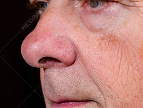 Extreme close up of senior nose in side view