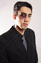 Business man black eye