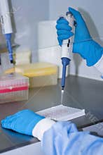 Carrying out the ELISA test