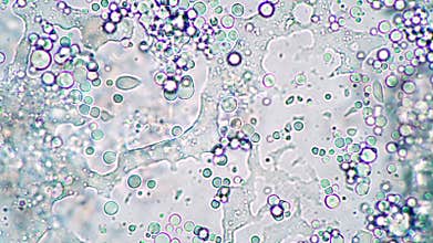 Bright clumps of lactic acid bacteria in dairy starter culture under the microscope