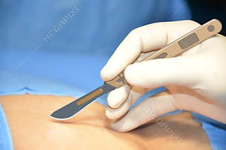 Scalpel & surgeon hand, ready for operation.
