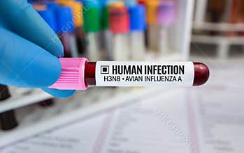 Doctor holding blood tube test with Human infection for Avian influenza A H3N8