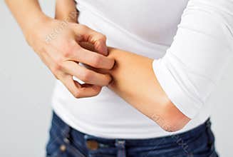 Woman scratching her arm