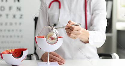 Doctor explains eyeball structure pointing pen at model