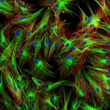 Fibroblasts (skin cells) labeled with fluorescence dyes