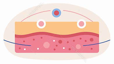 Skin Layer CrossSection A simplified crosssection of with highlighted areas showing where exosomes are applied