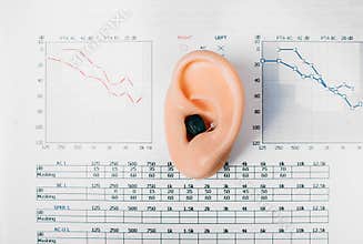 Audiometry, diagnosis of hearing impairment. Close-up of the hearing aid and ear model against the background of