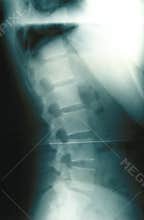 Human Spine Xray