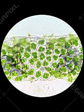 Plant cell with chloroplast under microscope