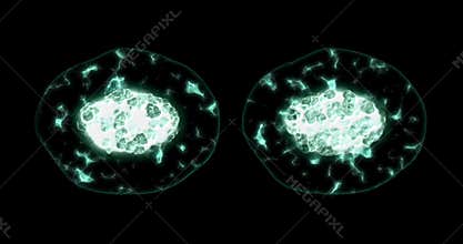 Microscopic view of mitosis, division or reproduction cell