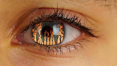 Fire in Human Eye