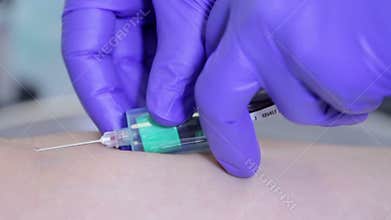 Doctor drawing blood sample from arm in green tube