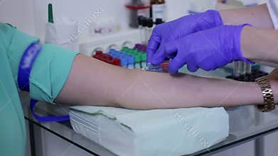 Doctor drawing blood sample from arm in red tube